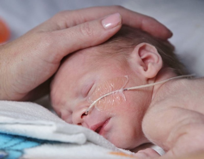 Jewish General Hospital Auxiliary's Tiny Miracle Fund photo